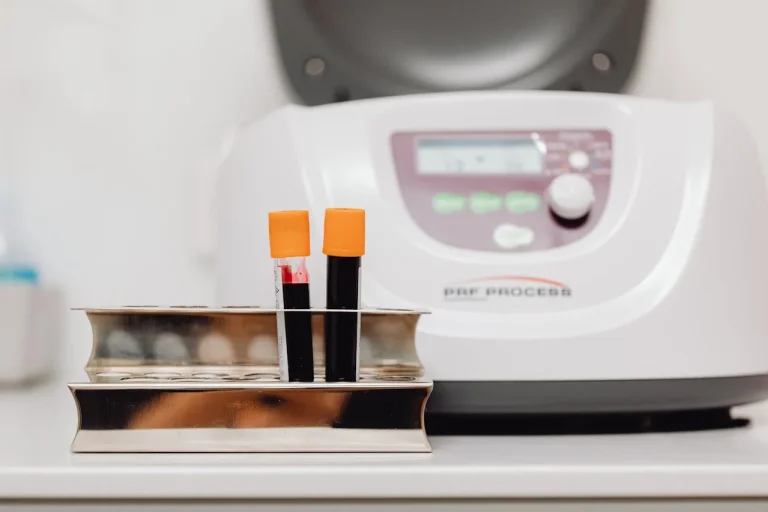 Ce analize trebuie făcute înainte de începerea unei cure de detoxifiere?